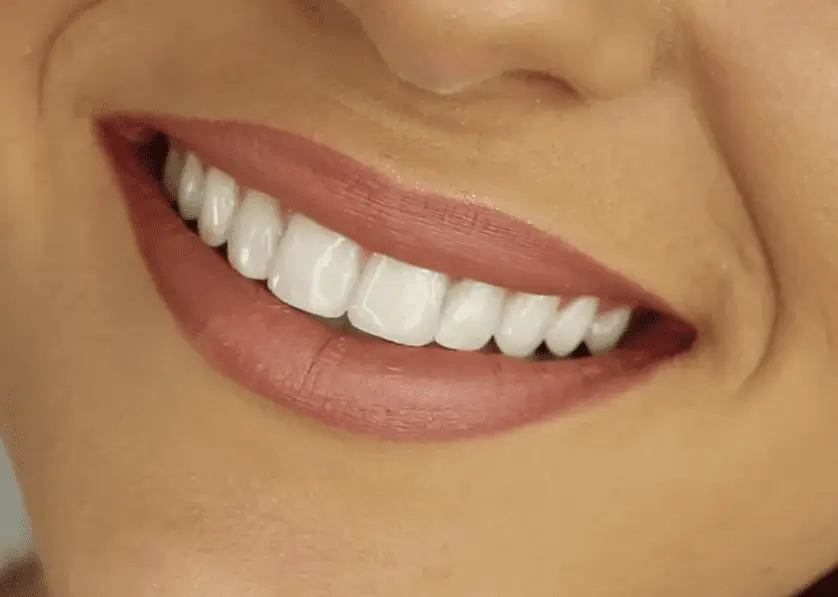 5 Ways To Get Whiter Teeth