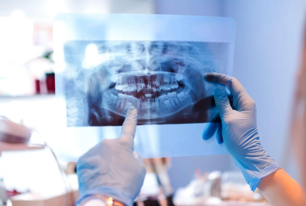 digital dental x-ray in brooklyn